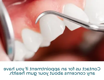 how long can you live with periodontal disease