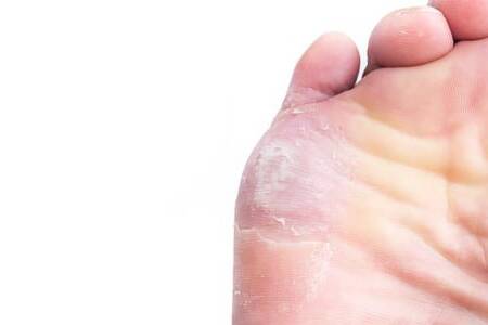 how long does athletes foot live on carpet